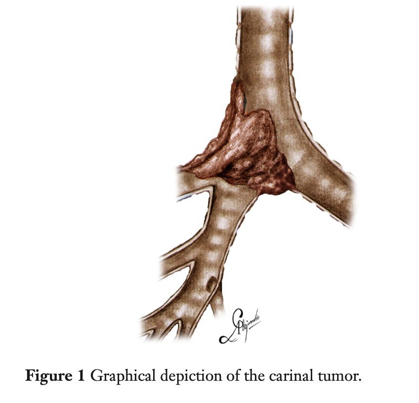 figure1.jpg