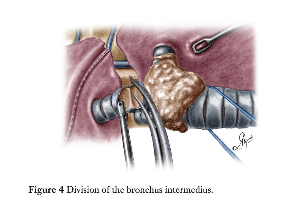 figure4.jpg