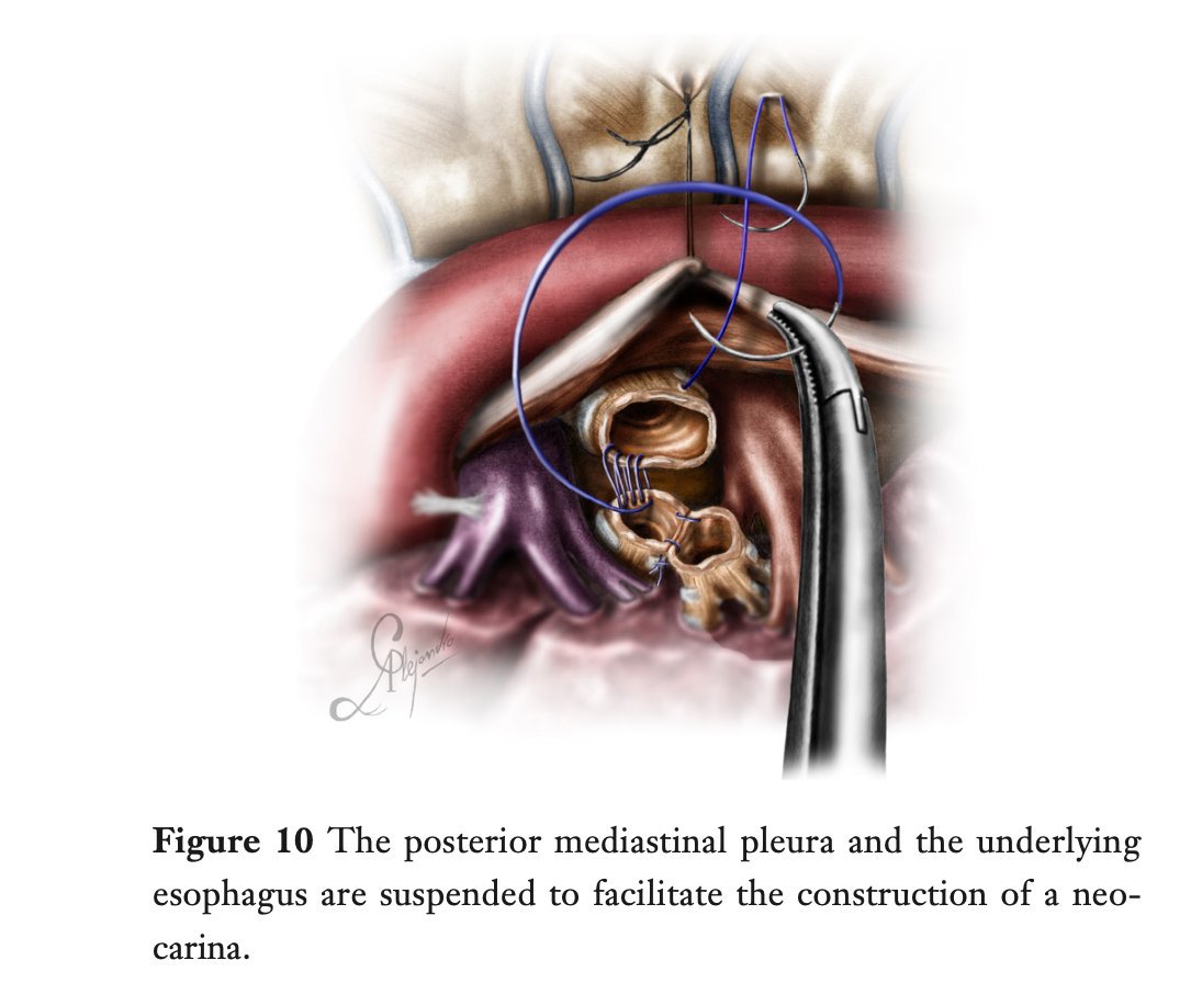 figure10.jpg