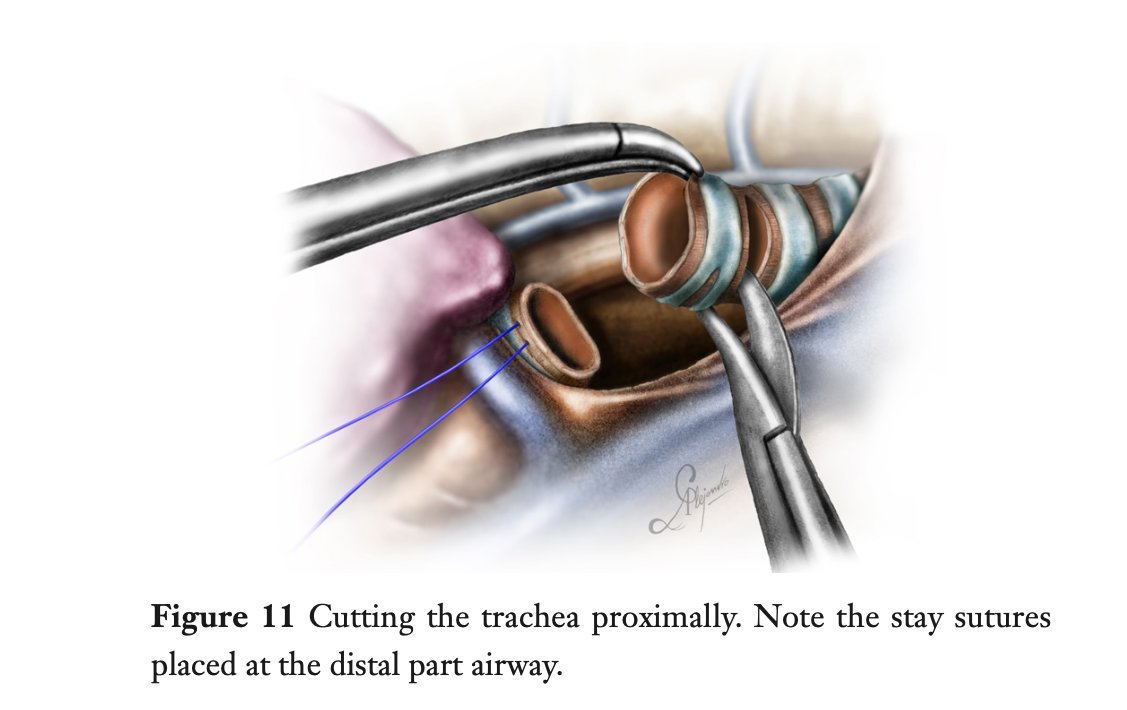 figure11.jpg